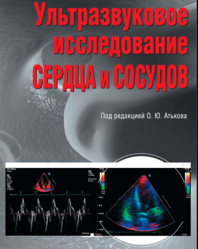 Ультразвуковая диагностика сердца и сосудов .Второе издание. (2015) PDF